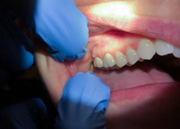 Best Weekend Emergency Dentist in Haysville, KS