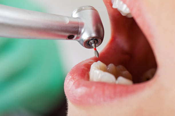 Best After-Hours Dental Trauma Care in Haysville, KS
